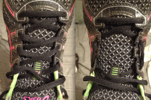 Before and after of the shoe lace method that i supposed to take pressure off the top of my foot.